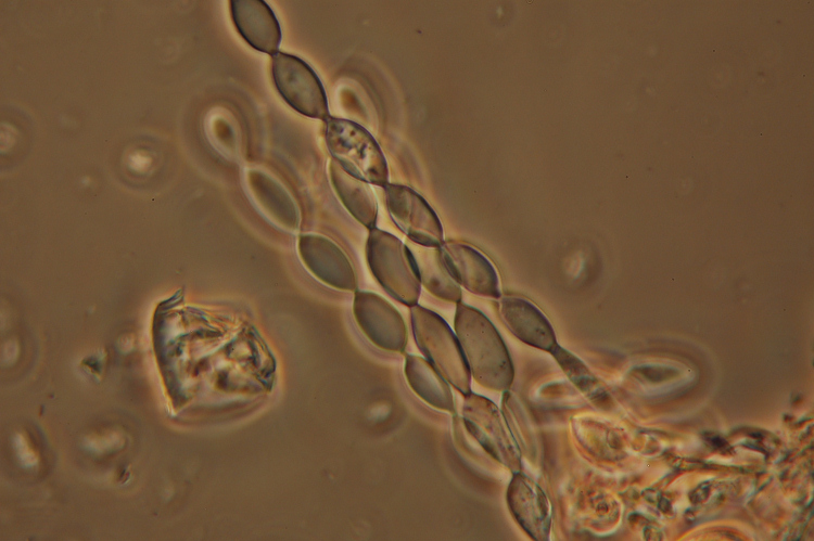 Botryobasidium aureum e il suo anamorfo Haplotrichum aureum